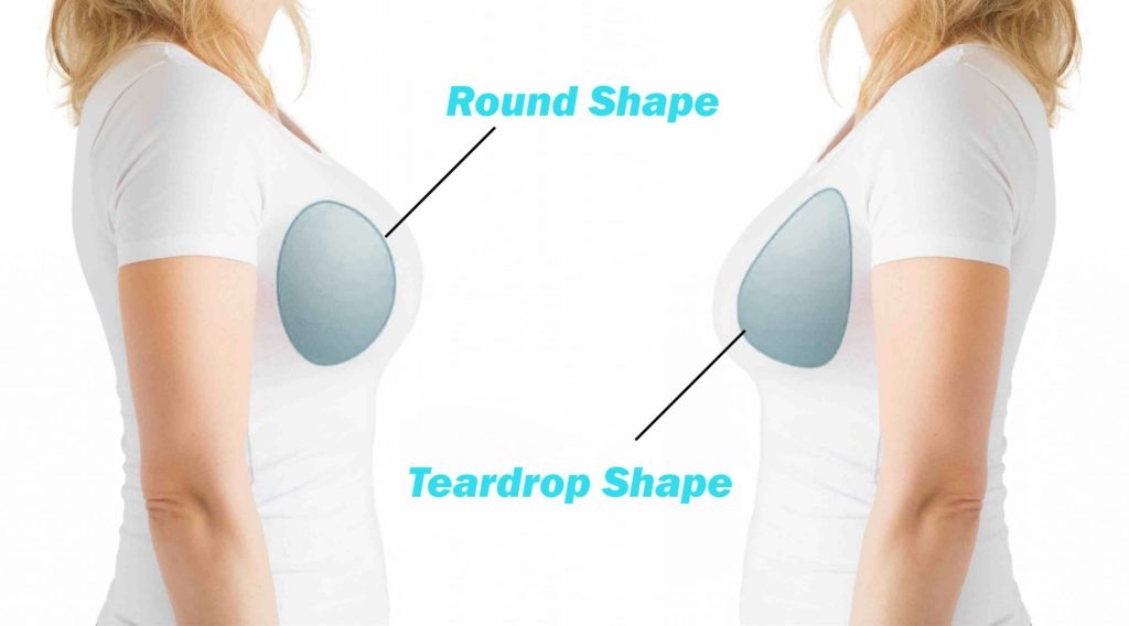 Natural-Looking vs. Round: How to Get Your Ideal Breast